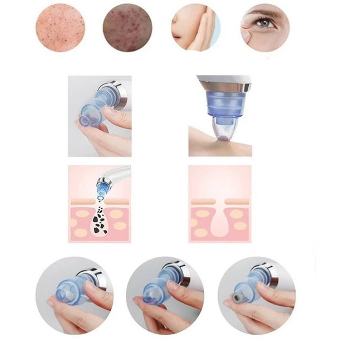 Вакуумный аппарат для очистки лица fs-05-1446