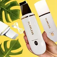 Ультразвукове чищення SKIN SCRUBBER (RD-1038)