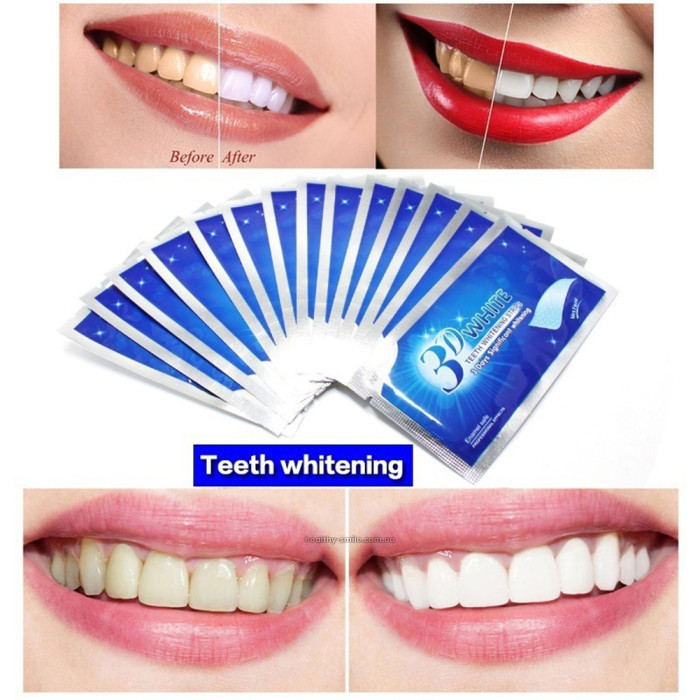 Відбілювальні смужки для зубів Smilekit 3D White Teeth Whiten AND 5510 уп. 10 шт.